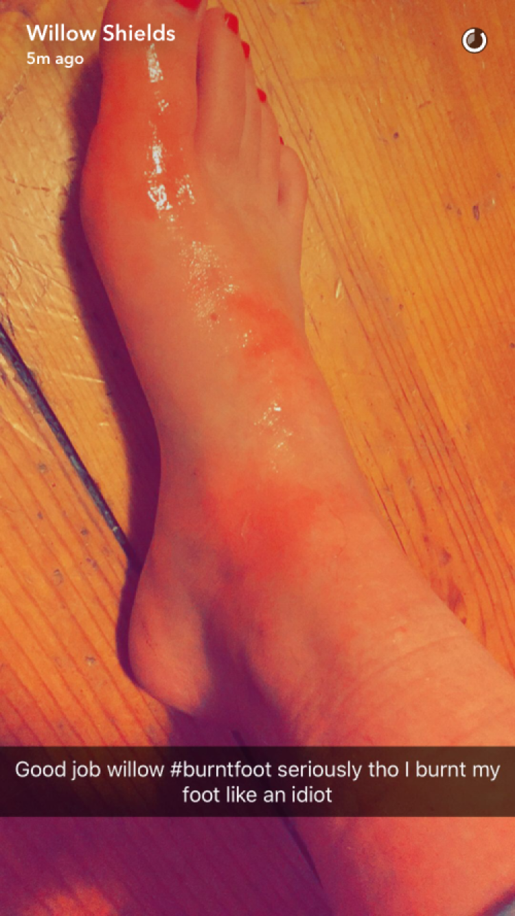 willow shields foot