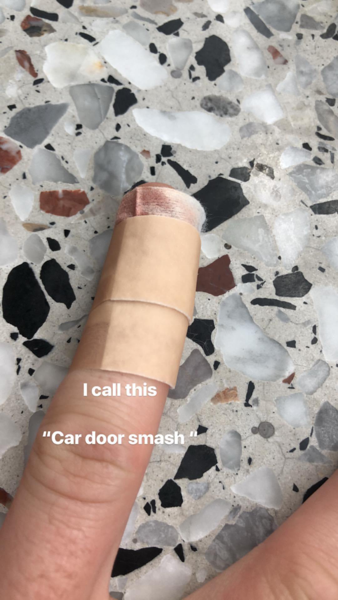 Niall Horan Posts Injury Pic On Instagram After Smashing Finger
