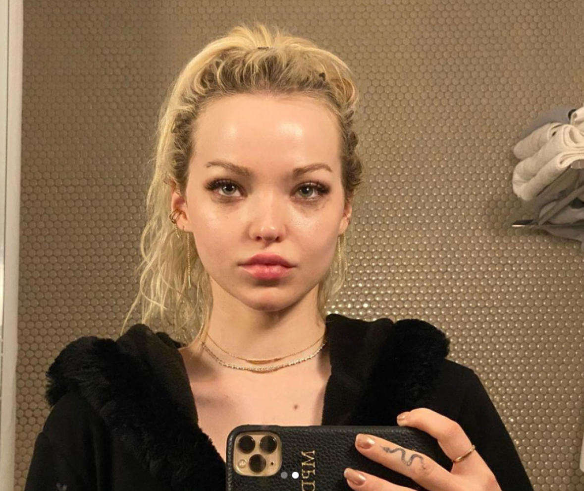 Dove Cameron Speaks Out About Her Past Struggles & The Importance Of Self Care