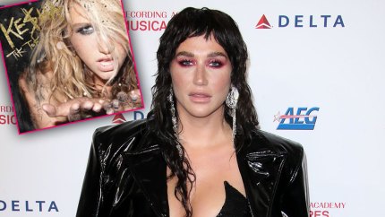 Kesha Recreates Her Iconic 'Tik Tok' Album Cover, And We Cannot Stop Laughing Over The Final Produc