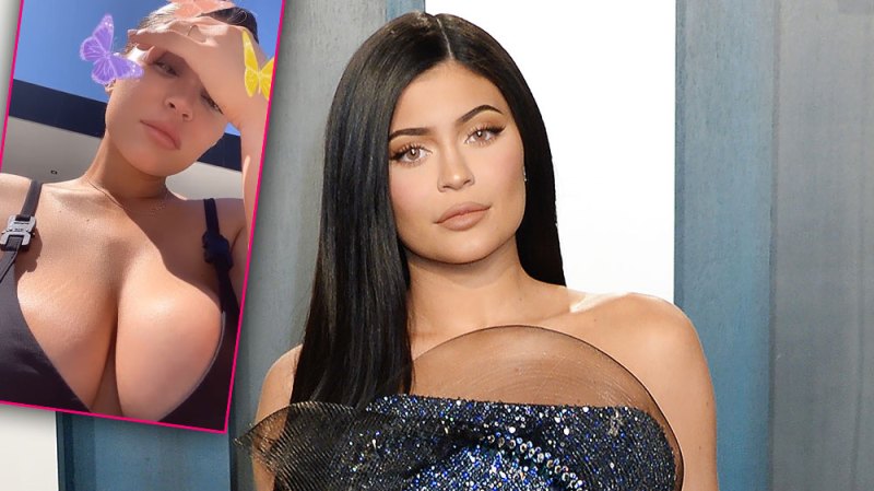Fans Praise Kylie Jenner After She Shows Off Her Stretch Marks In New Pic