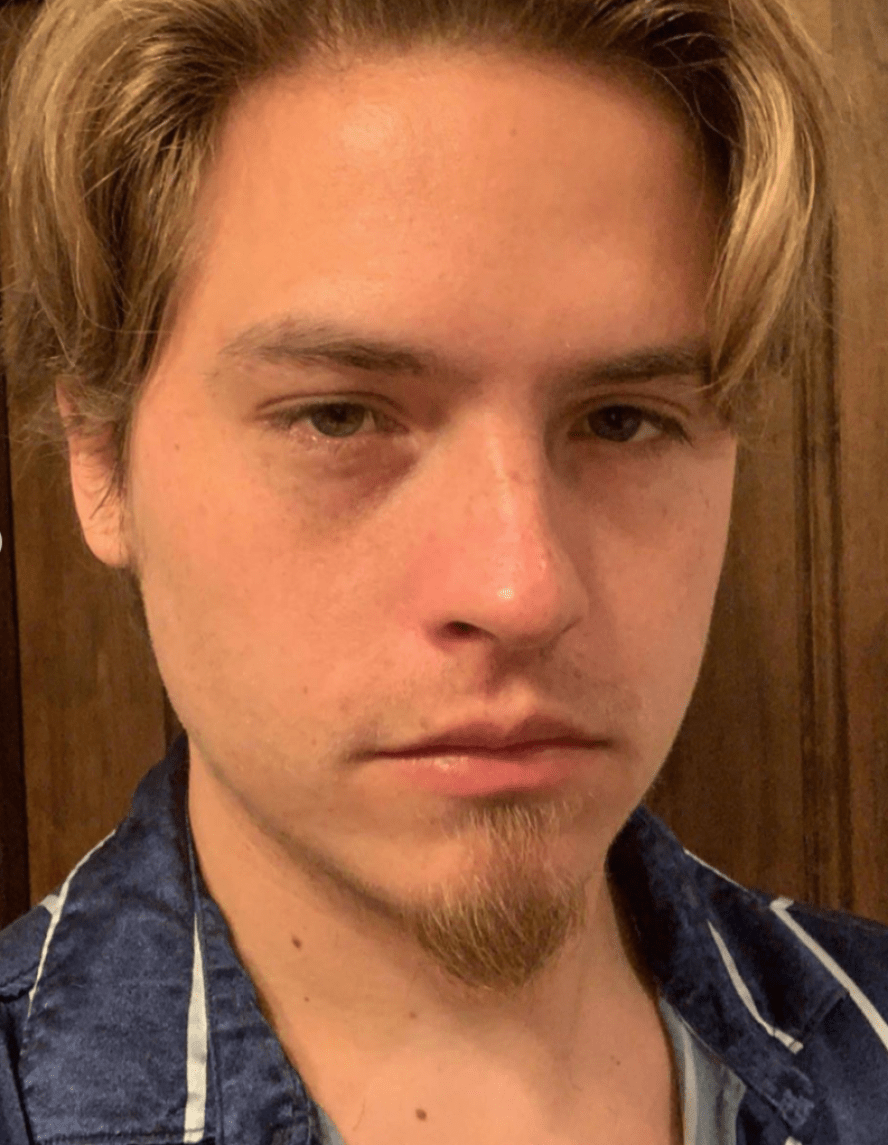 dylan sprouse shaves beard