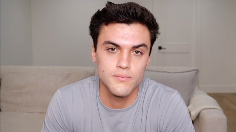 Ethan Dolan Recounts Constant Hate Because Of His Acne In Personal New Video