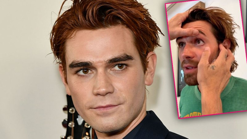 Fans Concerned After KJ Apa Reveals A Piece Of Legit Metal Is Stuck In His Eye