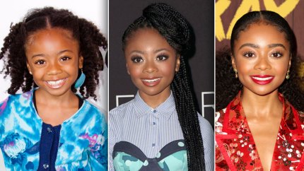 Skai Jackson Has Grown Up So Much Since Her Disney Channel Days — See Her Transformation in Photos