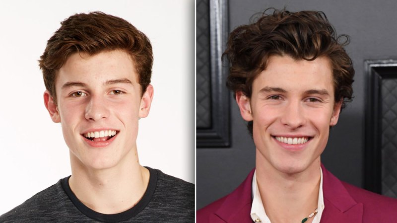 Vine Star to Hottie! Shawn Mendes' Total Transformation in Photos