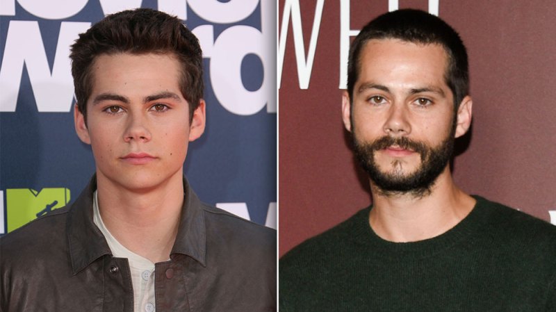 Dylan O’Brien's Transformation in Photos: From ‘Teen Wolf’ Star to Now
