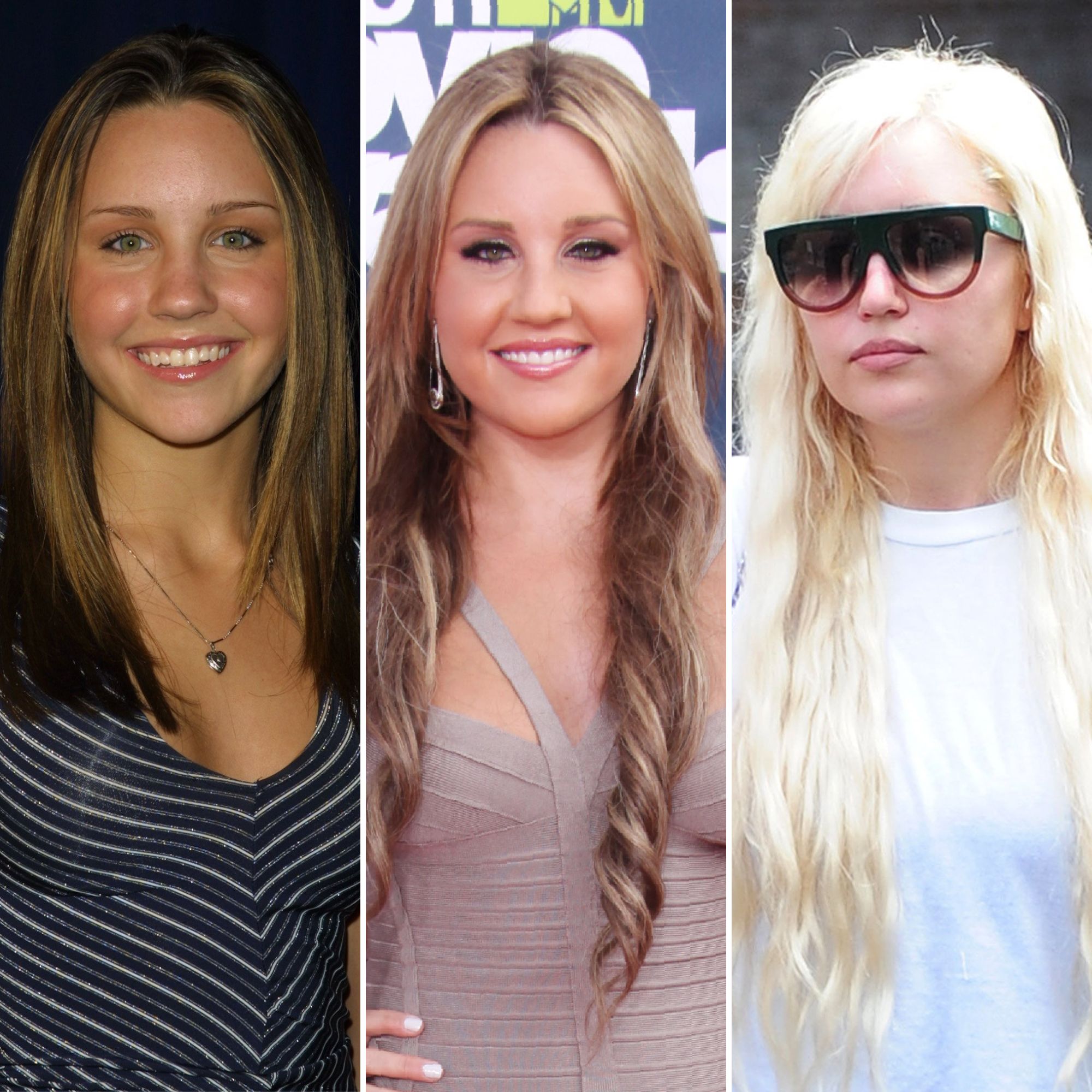 Amanda Bynes Transformation From Nickelodeon Star to Now