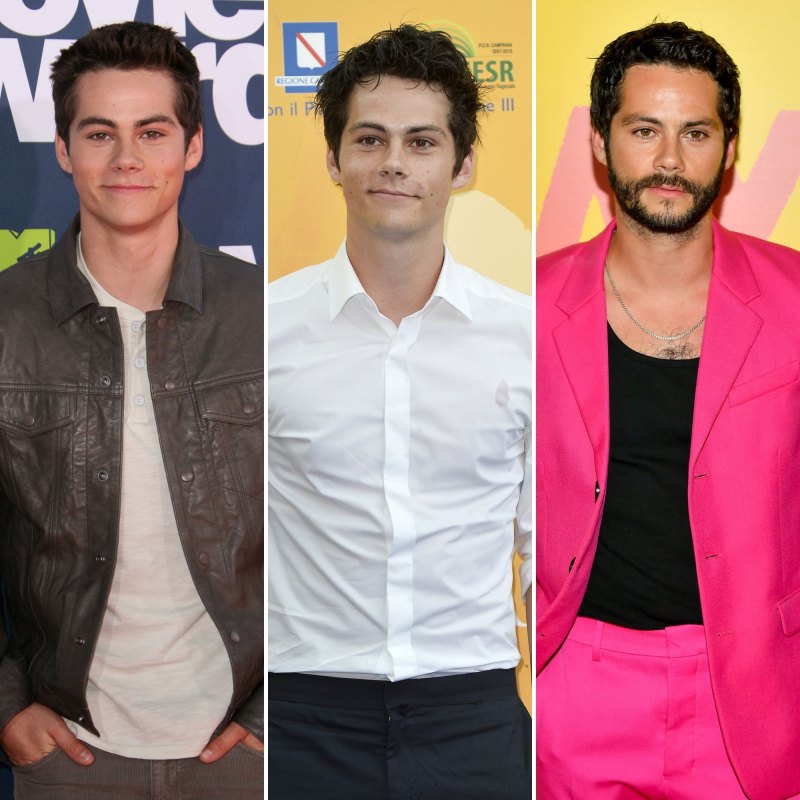 Dylan O’Brien's Transformation in Photos: From ‘Teen Wolf’ Star to Now